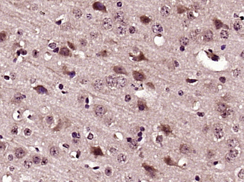 PEDF Rabbit Polyclonal Antibody