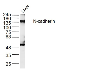 N-cadherin Rabbit Polyclonal Antibody