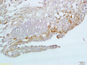 PIM1 Rabbit Polyclonal Antibody
