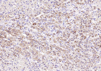 PENK Rabbit Polyclonal Antibody