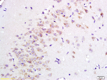 PENK Rabbit Polyclonal Antibody