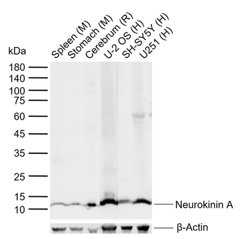 Neurokinin A Rabbit Polyclonal Antibody