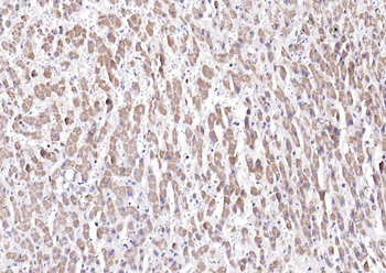 NFKB p65 Mouse Monoclonal Antibody