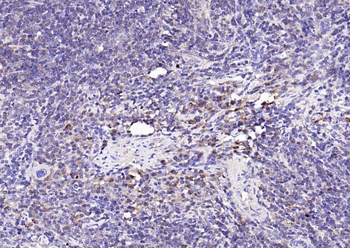 NFKB p65 Mouse Monoclonal Antibody