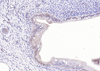 NFKB p65 Mouse Monoclonal Antibody