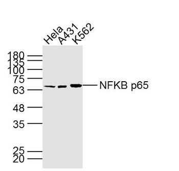 NFKB p65 Mouse Monoclonal Antibody