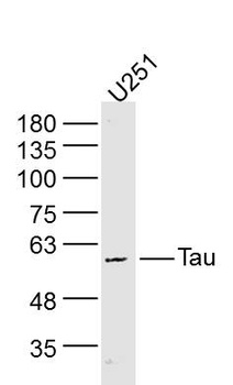 Tau antibody