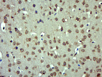 Angiotensinogen Rabbit Polyclonal Antibody