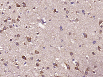 DRD2 Rabbit Polyclonal Antibody