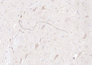 PGP9.5 Rabbit Polyclonal Antibody