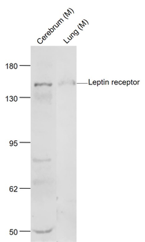 Leptin receptor Rabbit Polyclonal Antibody