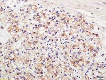 Claudin 5 Rabbit Polyclonal Antibody