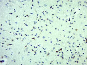 VWF Rabbit Polyclonal Antibody