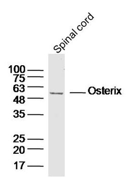 SP7/Osterix Rabbit Polyclonal Antibody