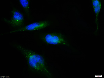 Nestin Rabbit Polyclonal Antibody
