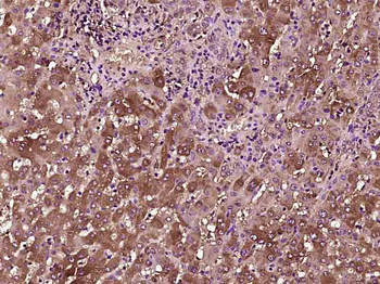 TTR/Prealbumin Mouse Monoclonal Antibody