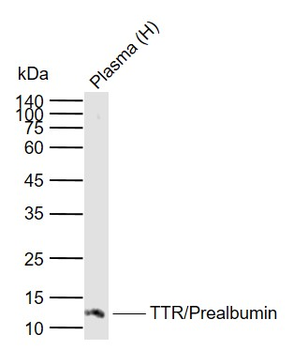 TTR/Prealbumin Mouse Monoclonal Antibody