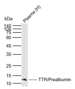 Transthyretin antibody