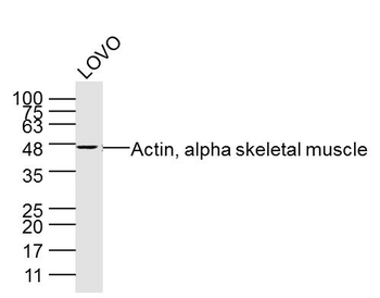 Actin, alpha skeletal muscle Mouse Monoclonal Antibody