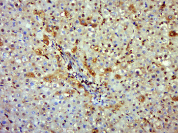 INos/Nos-2 Rabbit Polyclonal Antibody