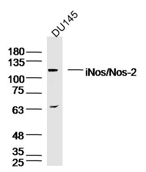 INos/Nos-2 Rabbit Polyclonal Antibody