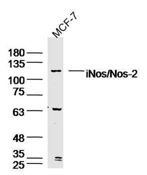 INos/Nos-2 Rabbit Polyclonal Antibody