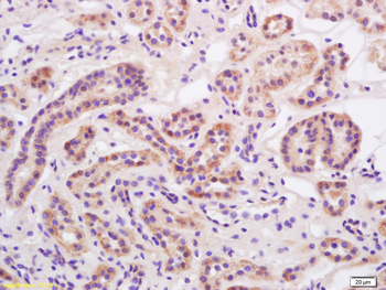 SCNN1A Rabbit Polyclonal Antibody