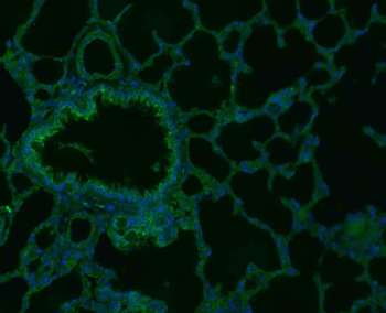 IFN gamma Rabbit Polyclonal Antibody