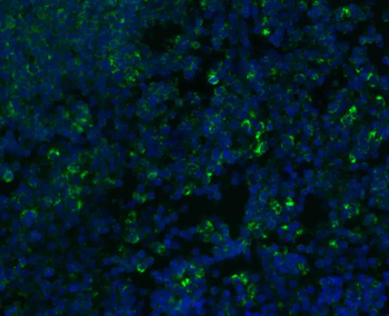 IFN gamma Rabbit Polyclonal Antibody