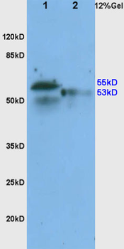 ADRB1 Rabbit Polyclonal Antibody