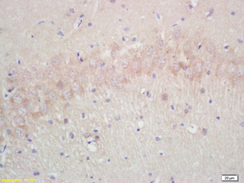 Aquaporin 4 Rabbit Polyclonal Antibody