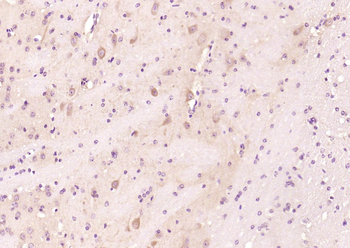 Cyclooxygenase 2 Rabbit Polyclonal Antibody