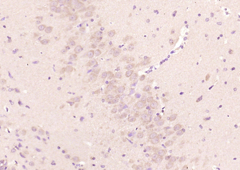 Cyclooxygenase 2 Rabbit Polyclonal Antibody
