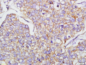 N-cadherin Rabbit Polyclonal Antibody
