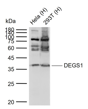DEGS1 Rabbit Polyclonal Antibody