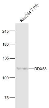DDX58 Rabbit Polyclonal Antibody
