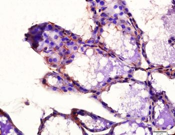 Phospho-PDGFRA (Tyr754) Rabbit Polyclonal Antibody