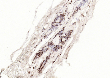 Phospho-STAT3 (Tyr705) Mouse Monoclonal Antibody