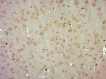 Phospho-Smad3 (Ser425) Mouse Monoclonal Antibody