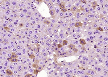 Phospho-Smad3 (Ser425) Mouse Monoclonal Antibody