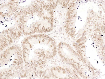 Phospho-Nrf2 (Ser40) Recombinant Rabbit Monoclonal Antibody