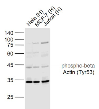 Phospho-beta Actin (Tyr53) Rabbit Polyclonal Antibody