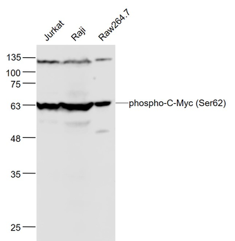 Phospho-C-Myc (Ser62) Rabbit Polyclonal Antibody