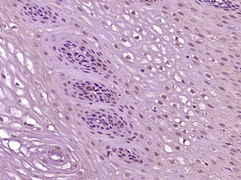 Phospho-C-Myc (Thr58) Rabbit Polyclonal Antibody