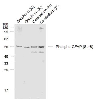 Phospho-GFAP (Ser8) Rabbit Polyclonal Antibody