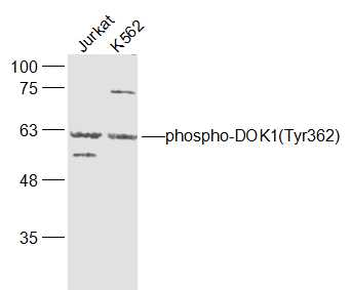 Phospho-DOK1 (Tyr362) Rabbit Polyclonal Antibody