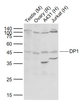 DP1 Rabbit Polyclonal Antibody