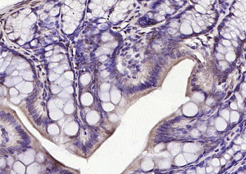 Phospho-E2F1 (Ser364) Rabbit Polyclonal Antibody