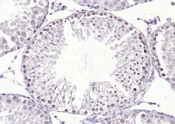 Phospho-E2F1 (Ser364) Rabbit Polyclonal Antibody