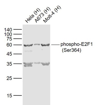 E2F1 (phospho-Ser364) antibody